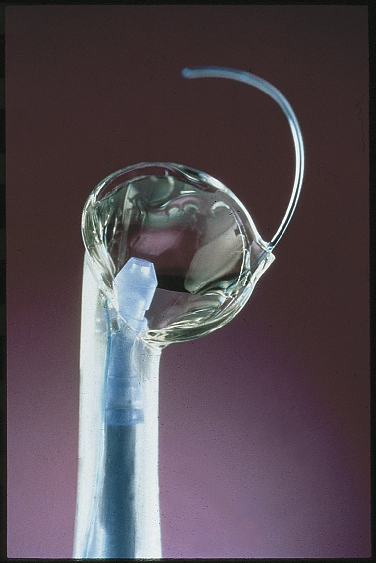 Surgical Procedures Eye Clinics of South Texas