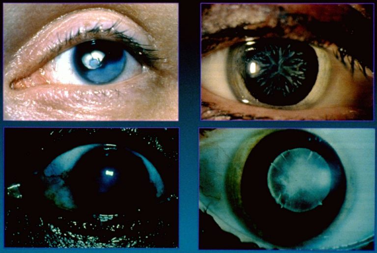 Cataracts Eye Clinics of South Texas, San Antonio